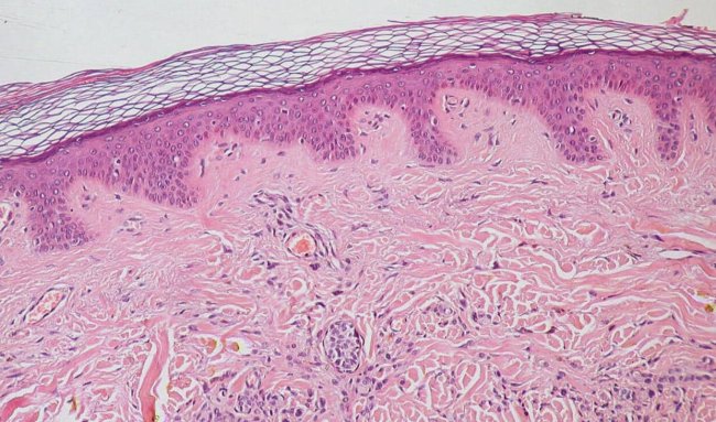 Ученые создали виртуальную модель эпителиальной ткани, способную прогнозировать развитие серьезных медицинских патологий - Интернет технологии.
