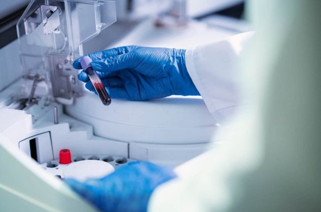 Ученые разработали препарат из клеток человеческой крови для борьбы с инфекциями и воспалениями - Интернет технологии.