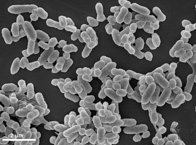 Две бактерии-комменсала сообща разрушили защитную слизистую стенку кишечника и вызвали хронический запор у мышей - Интернет технологии.