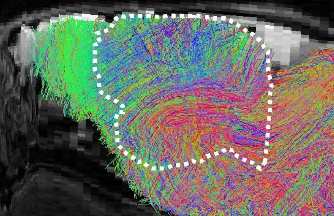 Биологи заменили кору мозга мышей на человеческую, чтобы изучать неврологические болезни - Интернет технологии.
