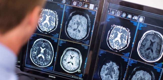 Ученые рассказали, когда заканчивается молодость - Наука.